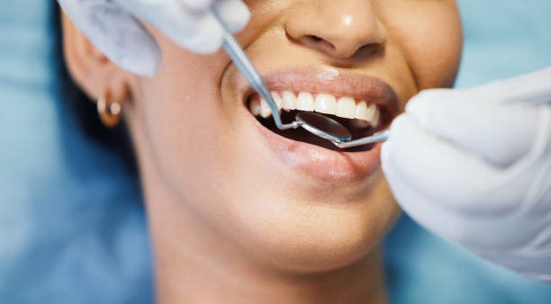 Best Emergency Tooth Extraction in Lancaster, OH